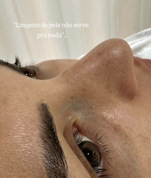 Pele saudável em close